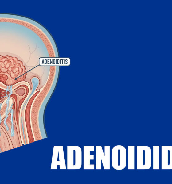 Adenoidid