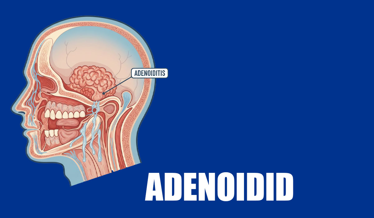 Adenoidid